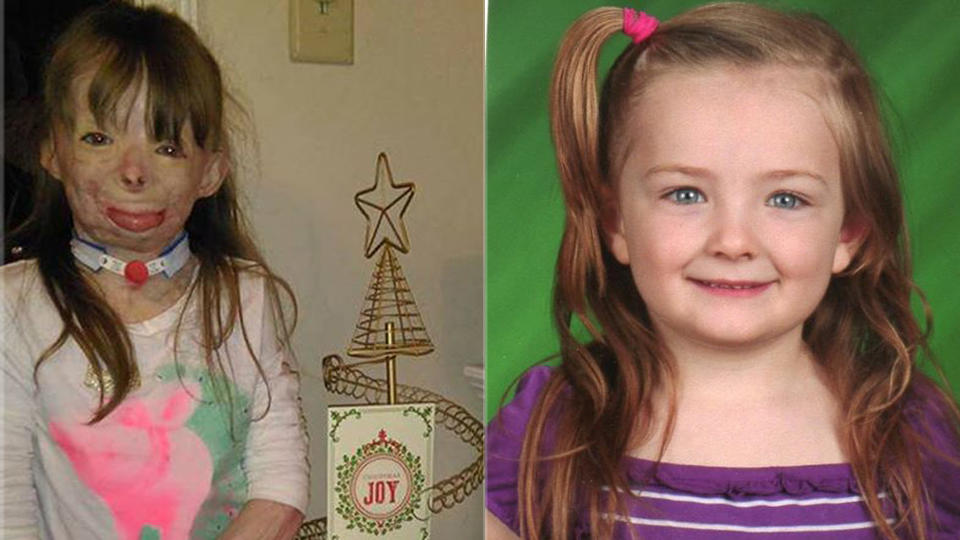 Familie in Flammenhölle verloren: Safyre (8) hat zu Weihnachten nur einen Wunsch Familie in Flammenhölle verloren: Safyra (8) hat zu Weihnachten nur einen Wunsch