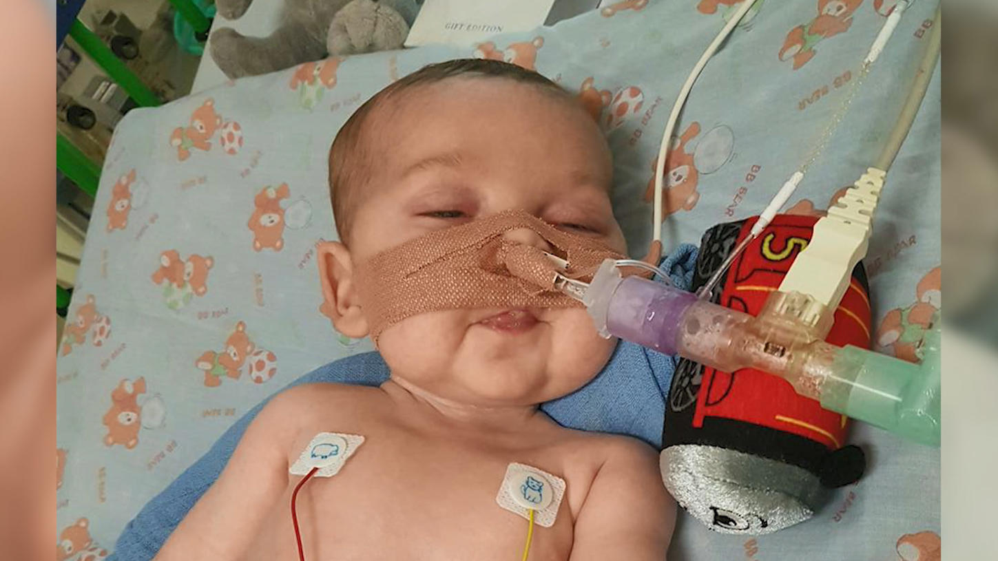 Darf Baby Charlie doch leben? Sieben Ärzte und 350.000 Bürger könnten seinen Tod aufhalten Baby Charlie liegt an Schläuchen angeschlossen im Krankenhausbett.