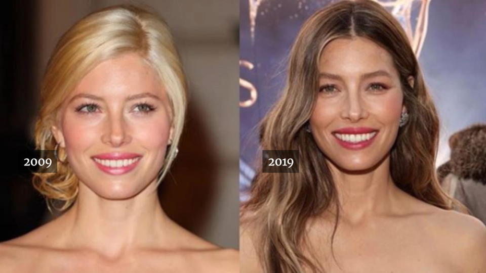 "10-Year Challenge" hält die Promis auf Trab