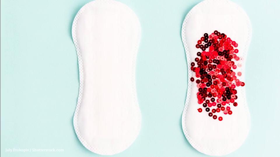Menstruationsblut und die Gesundheit Das verrät die Farbe der Regelblutung
