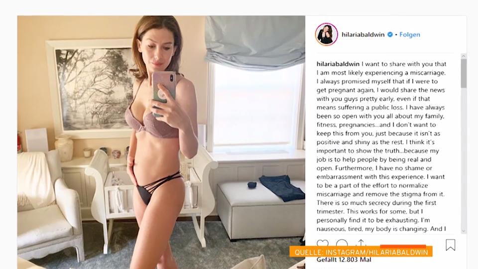 Offene Worte Hilaria Baldwin befürchtet eine Fehlgeburt