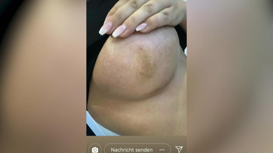 Schlammschlacht zwischen Jenny und Hakan Jetzt redet Jenny: Hakan hat mich geschlagen!