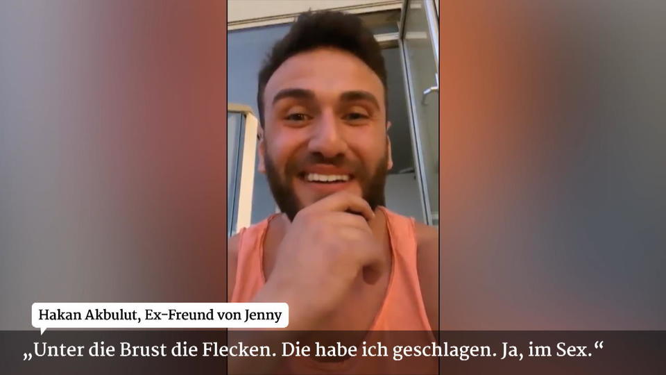 Wo kommen Jennys Flecken her? Hakan schockt mit krasser Aussage im Rosenkrieg