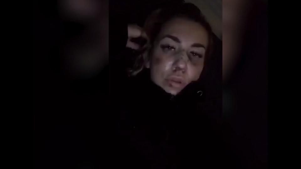 Nach E-Roller-Unfall So geht es "Paradise Hotel"-Star Miri