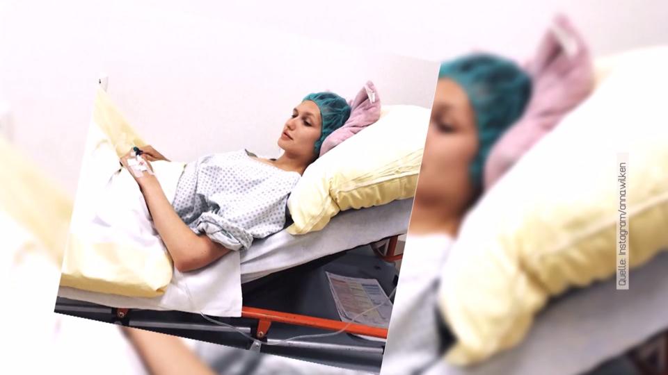 Geringe Chancen auf eigenes Kind Endometriose: Model Anna Wilken spricht über ihre Erfahrungen