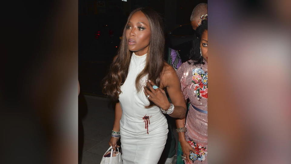 Model will auf Problem hinweisen Naomi Campbell bei Party mit Blutfleck am Kleid