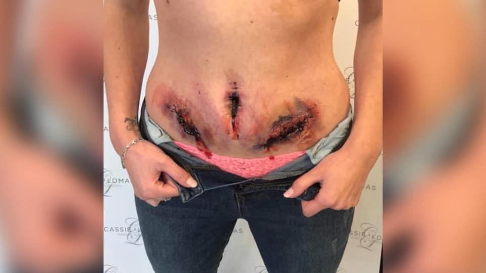 Make-up Artistin zeigt es So würde Endometriose aussehen