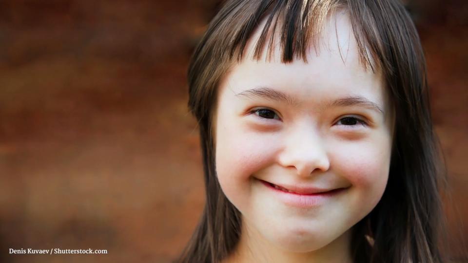 Trisomie 21 Was ist das Down-Syndrom?