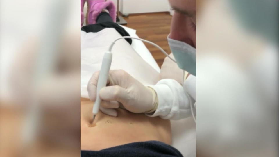 Besuch beim Beauty-Doc Die Katze unter dem Messer! Das stört sie schon so lange an ihrem Körper