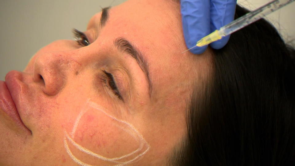 „Ich bin um 10 Jahre gealtert“ Djamila Rowe hat Sehsucht nach Beauty-Doc
