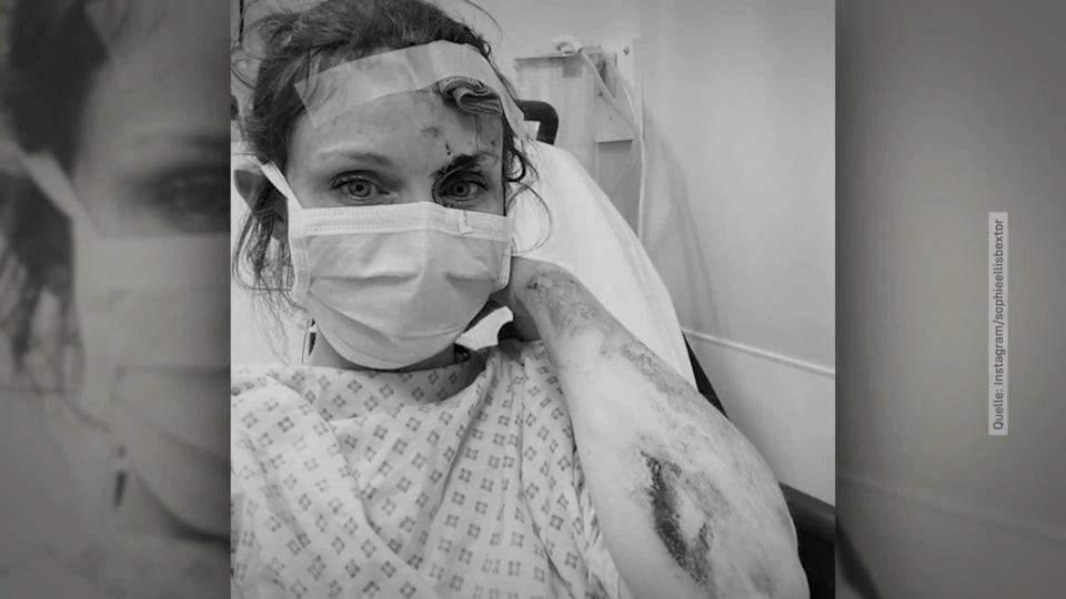 Sorge um Sophie Ellis-Bextor Sängerin nach Unfall im Krankenhaus