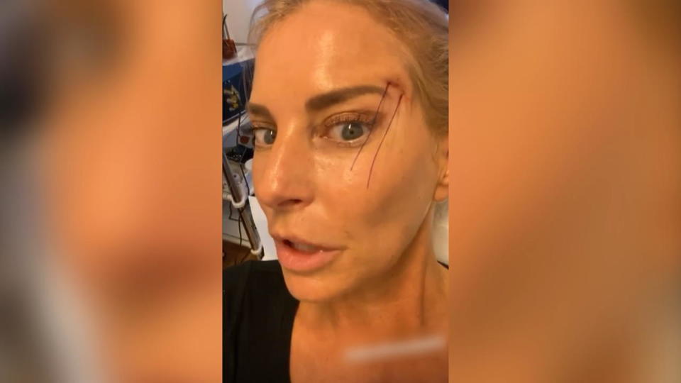 Lidstraffung bei der DJane Giulia Siegel nimmt ihre Follower mit zum Beauty-Doc