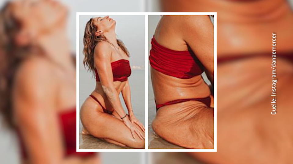 Instagram vs. Reality: Danae steht zu ihrem Body Influencerin Danae Mercer zeigt ihre Dellen
