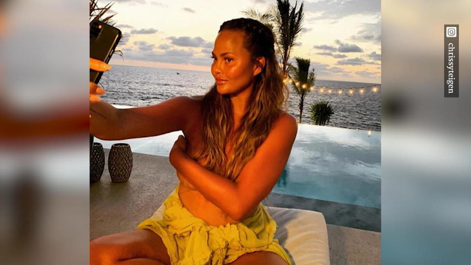 Brust-OP Nummer 2? Lässt sich Chrissy Teigen ihre Brüste noch einmal verkleinern?