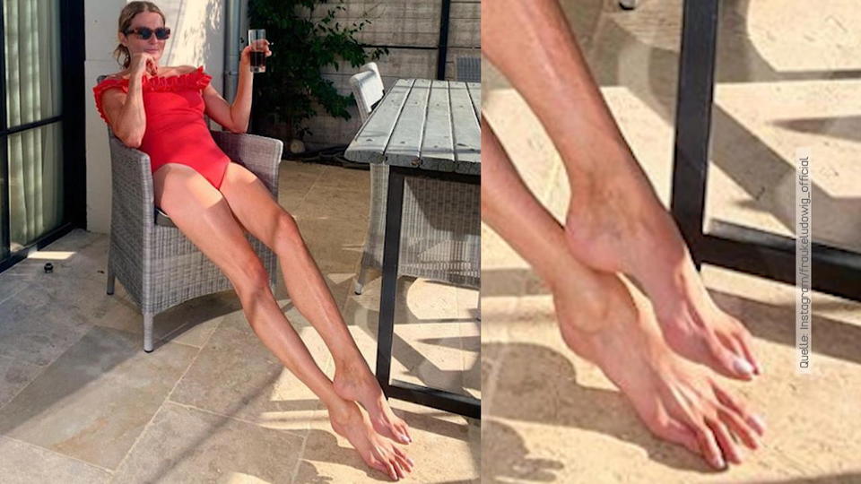Shitstorm auf Instagram Frauke Ludowig wird wegen ihrer Füße gemobbt