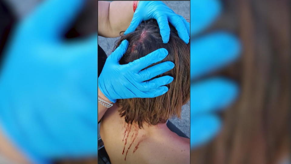 KJ Apa verletzt sich am Set Riverdale-Schauspieler verletzt sich am Set