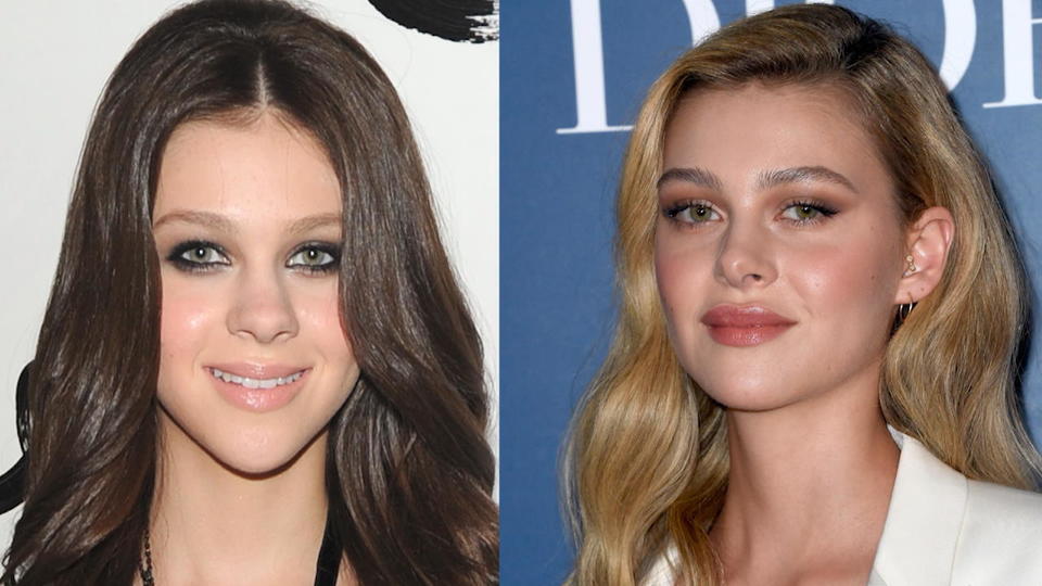 Beauty-OP? So krass hat sich Brooklyn Beckhams Verlobte verändert