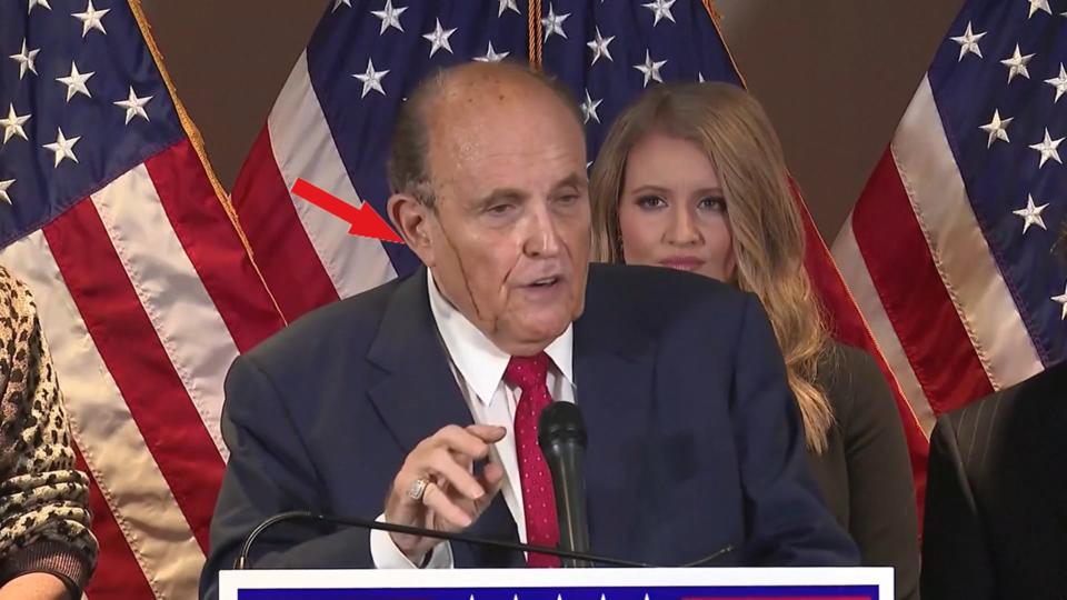 Fließende Haarfarbe und Selbstbräuner-Flecken Rudy Giuliani & Co.: Peinliche Make-up-Pannen der Promis