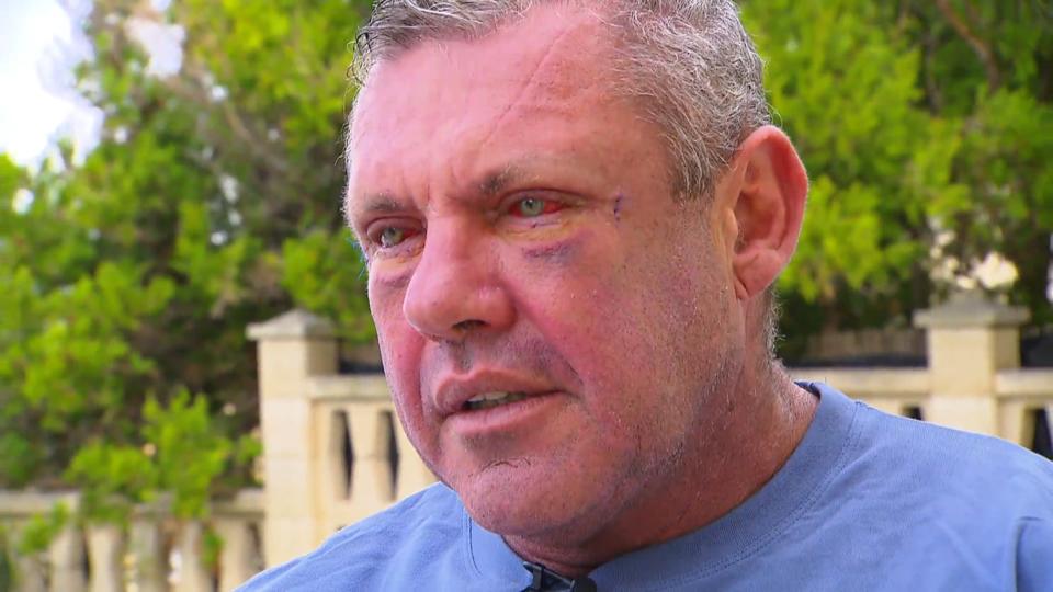 Der "Sommerhaus"-Gewinner sieht jetzt besser (aus) Andreas Robens hat sich unters Messer gelegt