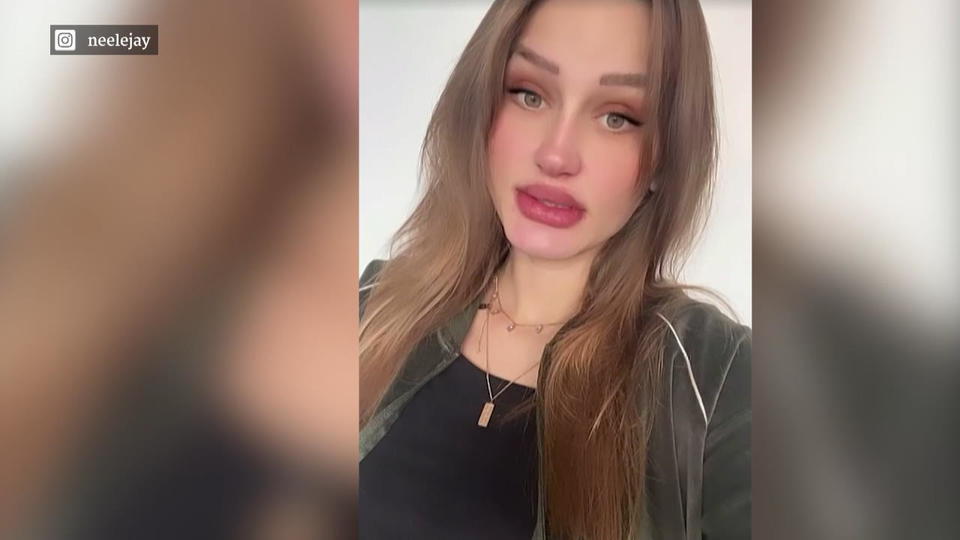 Die 24-Jährige ist im 9. Monat schwanger Schwangere GNTM-Neele unglücklich über Bauchrisse