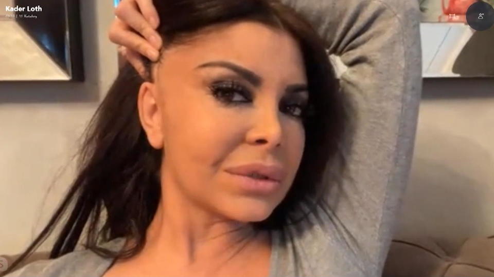 Haarausfall als Corona-Spätfolge Kader Loth fallen die Haare aus