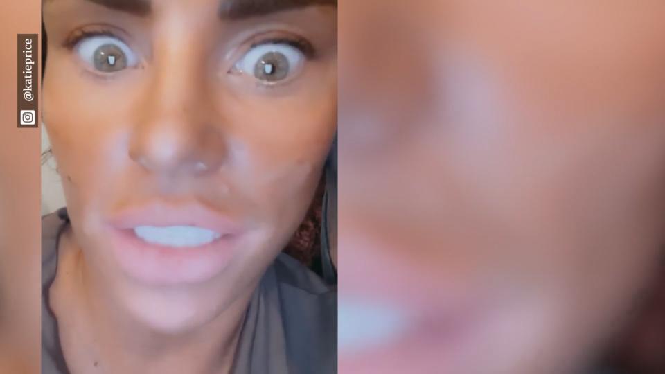 Fans sind irritiert Was ist falsch mit Katie Price Haut?