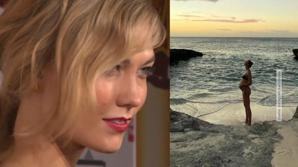 Baby für Supermodel Karlie Kloss ist Mama geworden