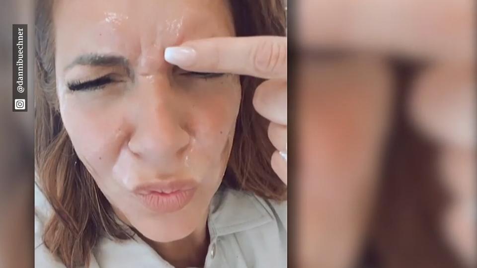 Tschüss, Zornesfalte! Danni Büchner lässt sich botoxen