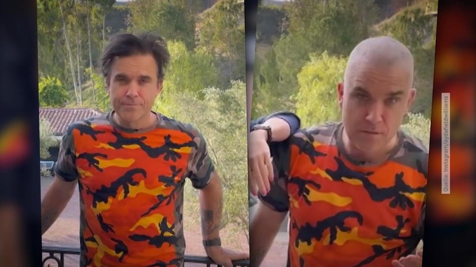 Weg mit der Wuschelmähne Kahlschlag für Robbie Williams