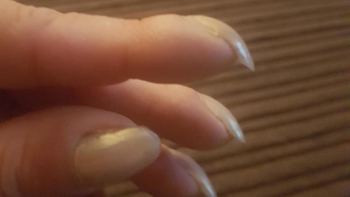 Lungenkrebs An Veranderten Fingernageln Erkennen Diese Nagelform Kann Ein Hinweis Sein