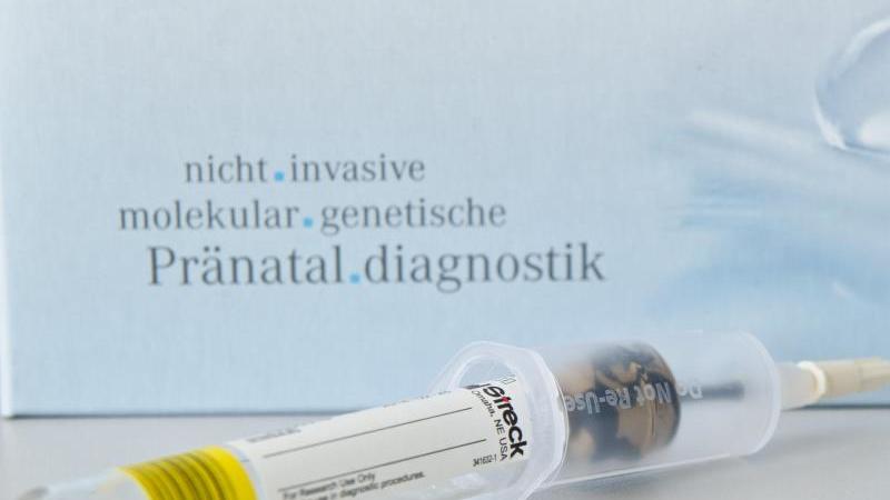 Down-Syndrom-Bluttest