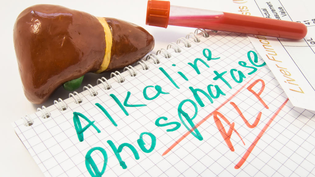 Leber Figur, Reagenzgläser mit Blut, Leber-Funktion-Testergebnis sind in der Nähe von Inschrift alkalische Phosphatase-ALP.