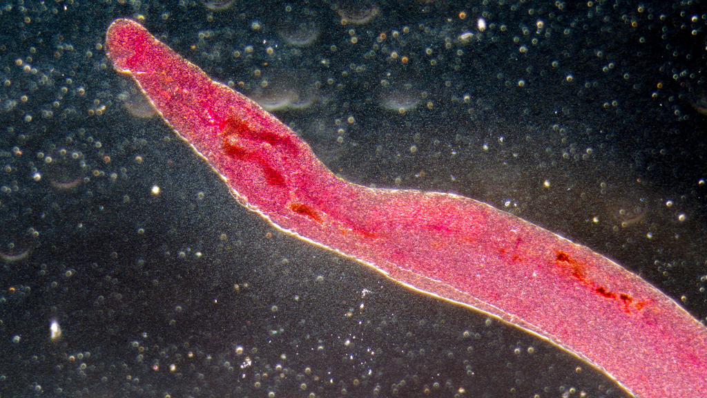 Reisende können sich in tropischen Gewässern mit Bilharziose infizieren. Dabei befallen Parasiten Darm und Harnwege.