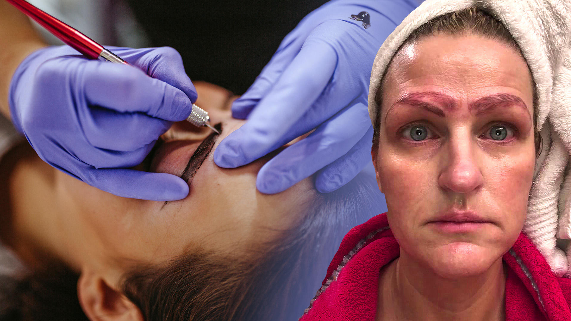 Microblading Fail Frau Hat Plotzlich Vier Augenbrauen