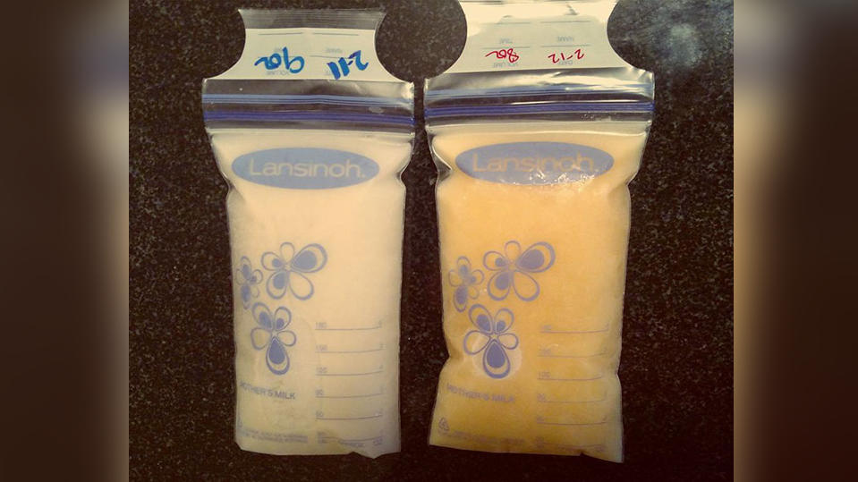 Mallory Smothers' verfärbte Muttermilch