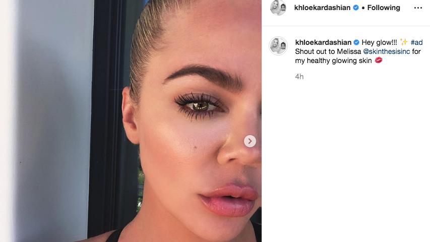Khloé Kardashian