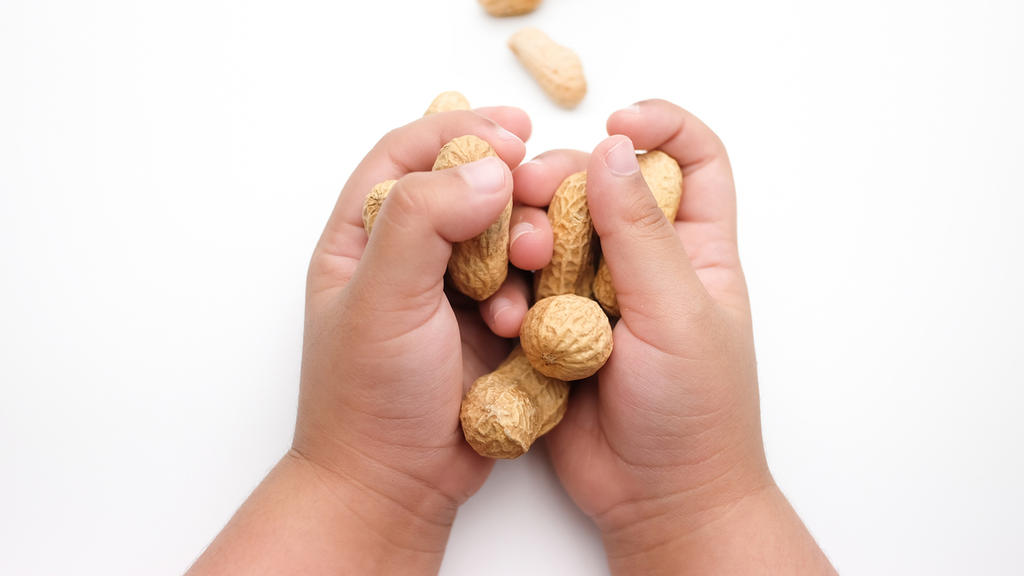 Viele Kinder leiden unter einer Erdnussallergie.