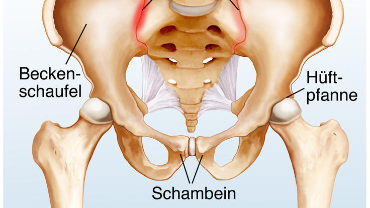 Schmerzen muskel schambein steißbein Gesäßschmerzen