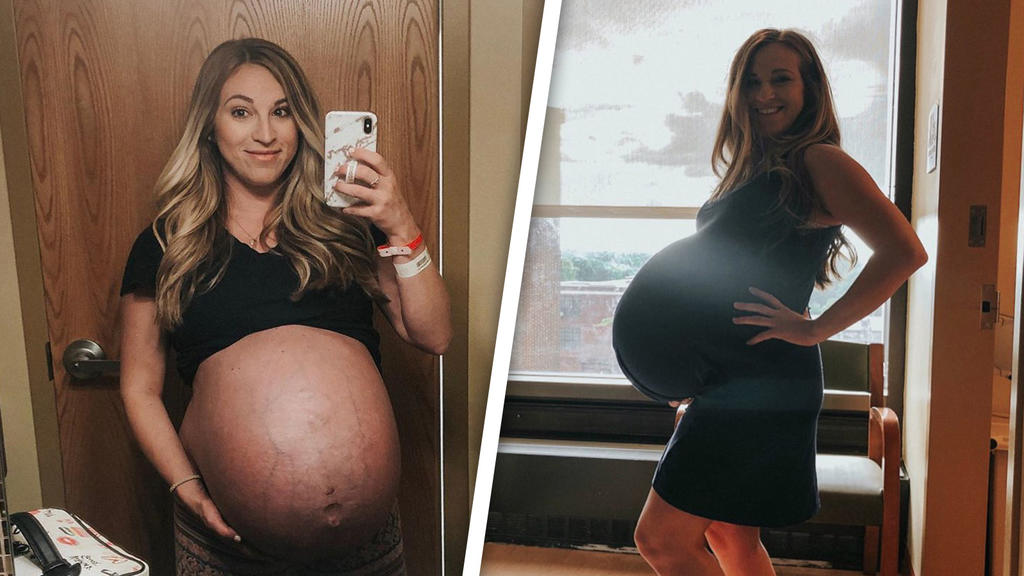 Ein ganz schön riesiger Babybauch, nicht wahr?