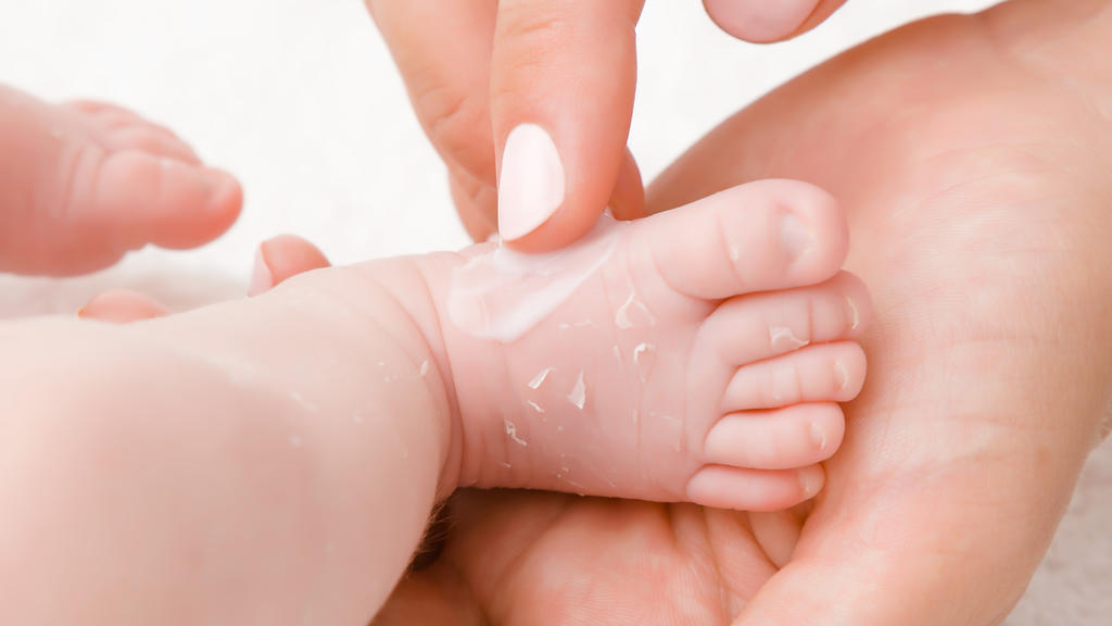 Mutter trägt Creme auf trockene Babyhaut auf