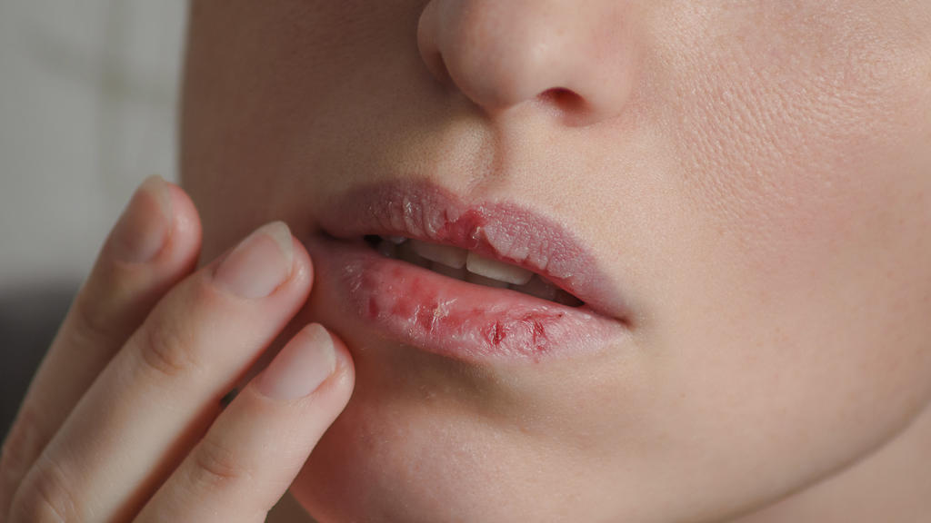 Rizinusöl macht trockene Lippen wieder weich und gepflegt.