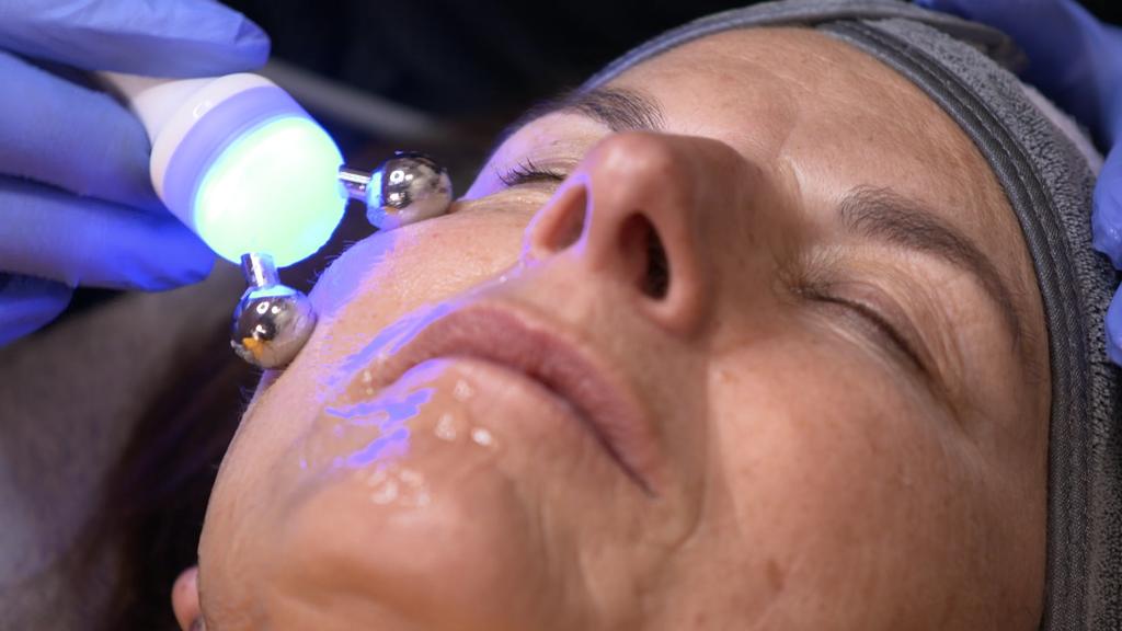 Claudia Obert verjüngt sich durch Ionen-Lifting.