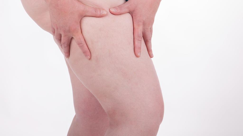 Eine dicke Frau betrachtet die Cellulite auf ihrem Oberschenkel.