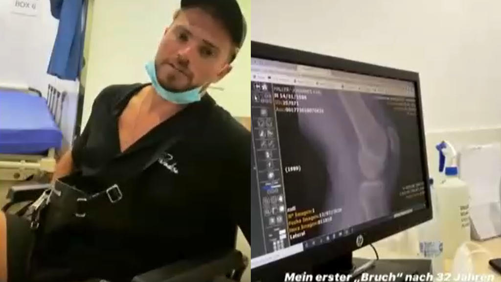 Johannes Haller im Rollstuhl (l.): Sein Knie (Röntgenbild, r.) macht ihm zu schaffen.