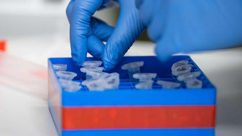 ARCHIV - 23.01.2020, Berlin: Eine Laborantin sortiert im Institut für Virologie an der Charite Berlin Mitte, in dem Untersuchungen zum Coronavirus laufen, Proben. In Deutschland ist erstmals eine Infektion mit dem neuartigen Coronavirus bestätigt wor