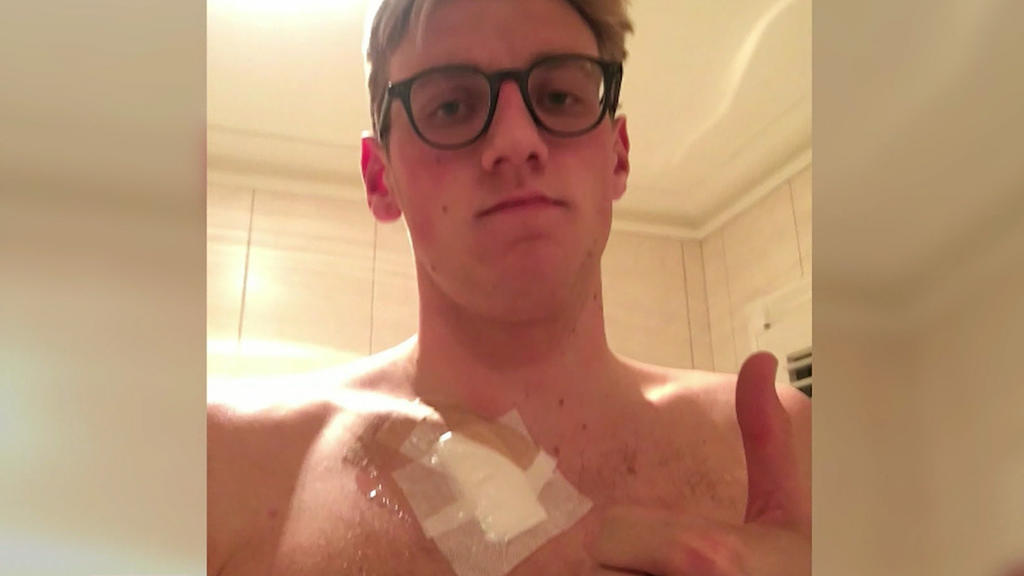 Mack Horton auf Instagram. Ein großes Pflaster bedeckt sein Schlüsselbein nachdem er sich ein Muttermal hat entfernen lassen.