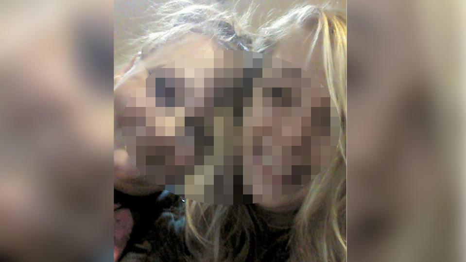 Crystal Meth: Kaylee M. (20) kratz sich im Wahn die Augen aus