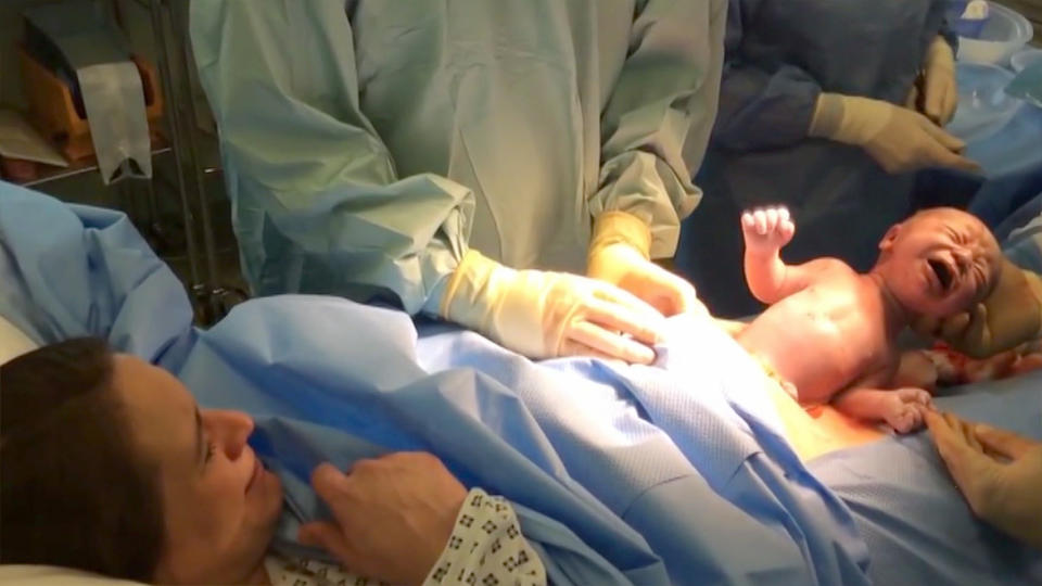 Natürlicher Kaiserschnitt Dieses Baby drückt sich fast selbst aus dem