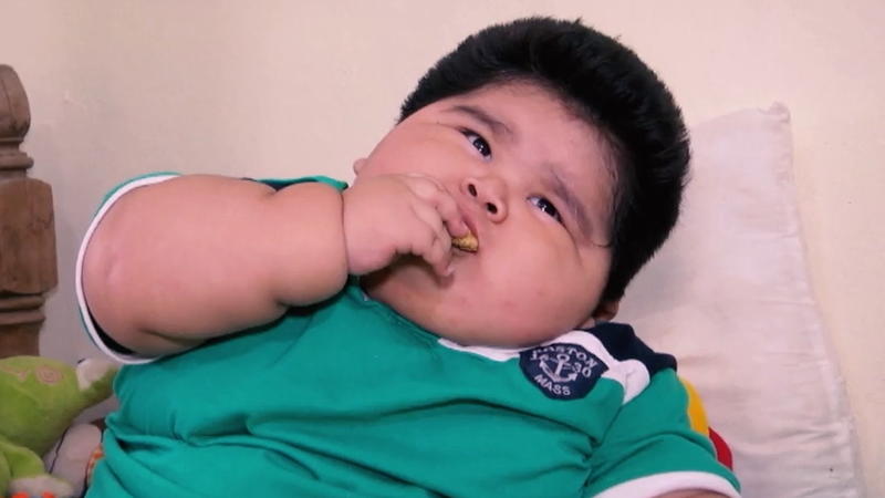 Mexiko Baby Luis (1) wiegt fast 30 Kilo