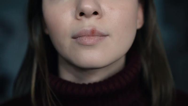Gesundheitslexikon Herpes